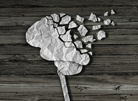 Alzheimer